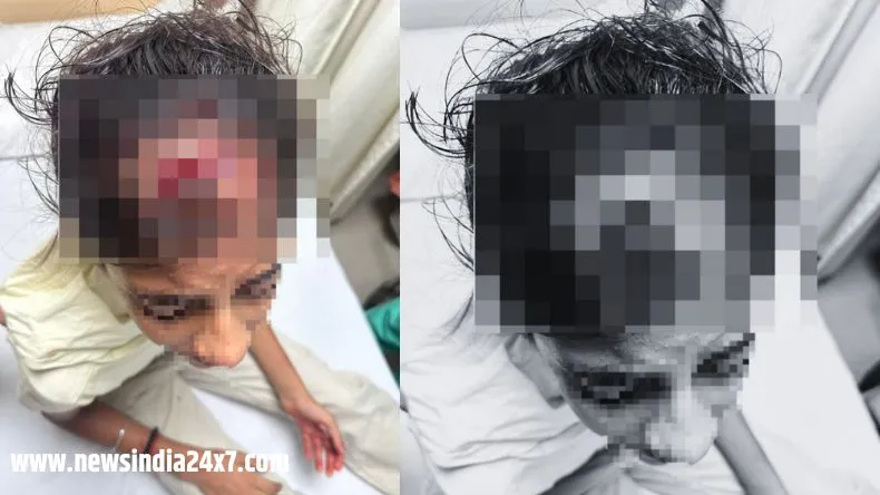 नोएडा में 25वें फ्लोर से गिरा ईंट का टुकड़ा : ट्यूशन पढ़ने जा रही मासूम का सिर फटा