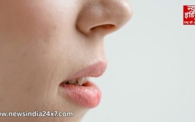 Cracked lip corners: होंठों की सर्दियों वाली मुश्किल खत्म! जानें क्यों फटते हैं और क्या करें…