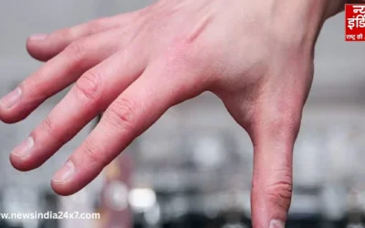 सर्दियों में हाथ-पैर की उंगलियां अचानक क्यों सूजने लगती हैं? असली कारण चौंकाने वाले, जानें कैसे करें बचाव