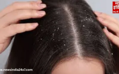 डैंड्रफ से कैसे पाए छुटकारा, सिर की सफेद पपड़ी हटाने के लिए अपनाएं ये 4 असरदार देसी नुस्खे