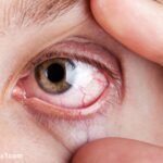 Eye diseases symptoms: