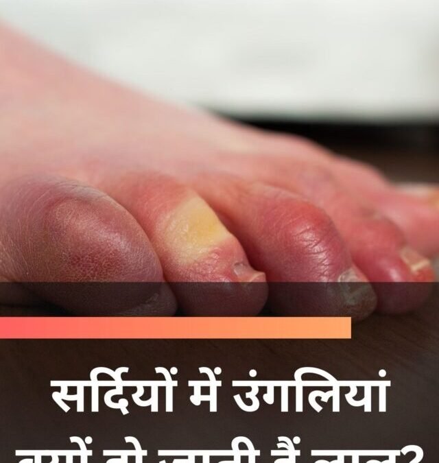 सर्दियों में उंगलियां क्यों हो जाती हैं लाल?
