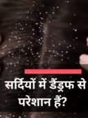 सर्दियों में डैंड्रफ से परेशान हैं?