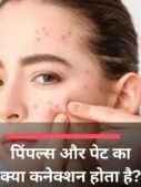पिंपल्स और पेट का क्या कनेक्शन होता है?