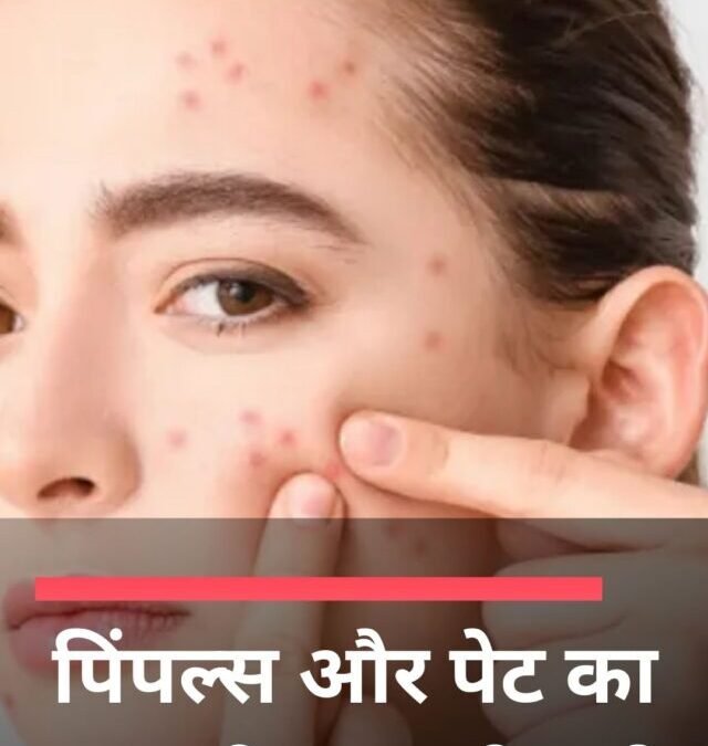 पिंपल्स और पेट का क्या कनेक्शन होता है?