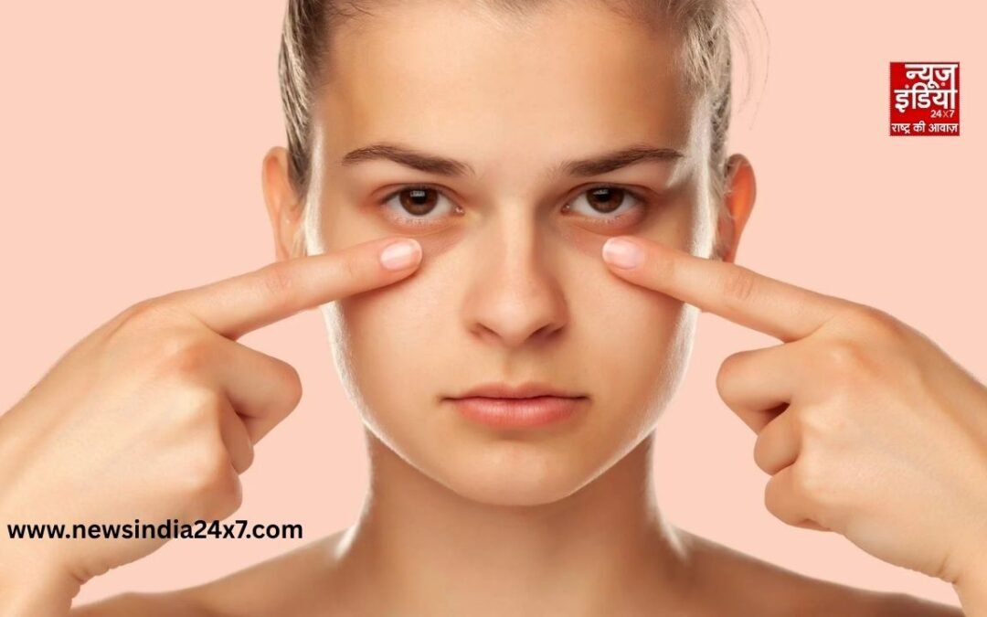 आंखों के नीचे सूजन और काले घेरे होंगे खत्म, अपनाएं ये घरेलू उपाय